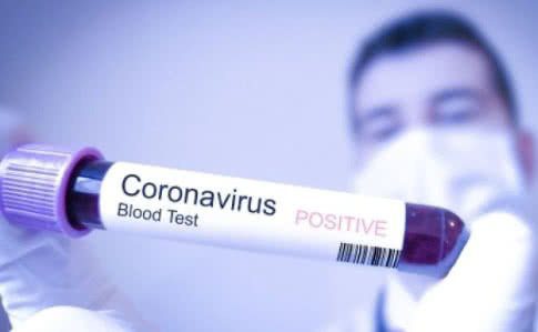 Що робити, якщо ви запідозрили у себе AMO Team Алгоритм дій