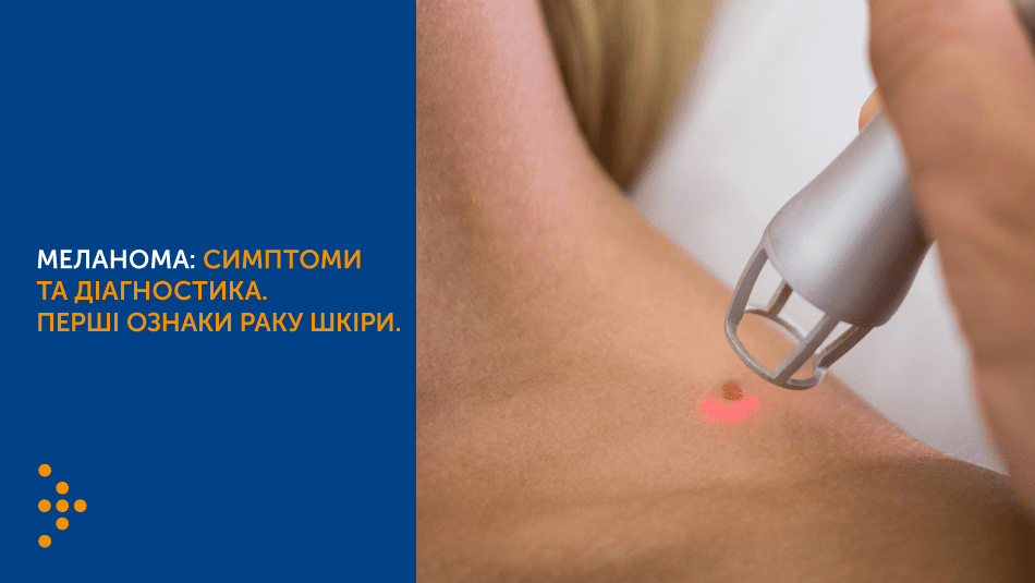 МЕЛАНОМА: СИМПТОМИ, ДІАГНОСТИКА ТА ПРОФІЛАКТИКА