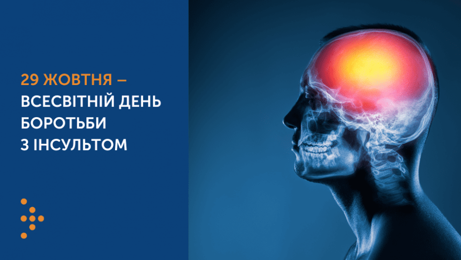 29 ЖОВТНЯ – ВСЕСВІТНІЙ ДЕНЬ БОРОТЬБИ З ІНСУЛЬТОМ: ЯК РОЗПІЗНАТИ СИМПТОМИ ТА ЧОМУ ВАЖЛИВО ЗРОБИТИ ЦЕ ВЧАСНО