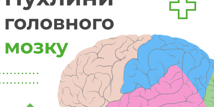 Пухлини головного мозку