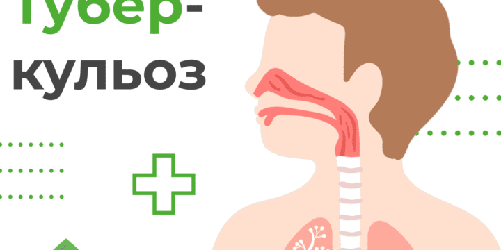 Туберкульоз